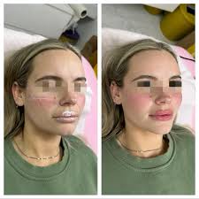 Aesthetics by Carmen Carter