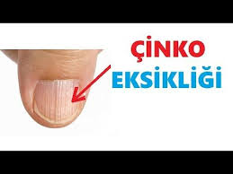 Cinko Eksikligi Nelere Yol Acar Nasil Giderilir Youtube Saglikli Iliskiler Youtube Saglikli Yasam