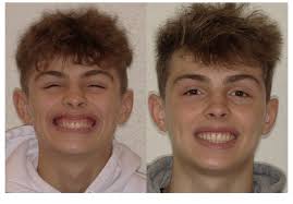 Cole Orthodontic Associates