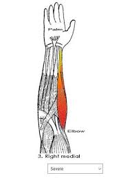 In this video i'm gonna give you an overview of the course. Forearm Rsi Pain Mapper Tracker Diary For Android Apk Download