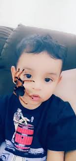 Medo de Aranha? 🕸️🕷️😁 #aranha #arachnophobia #efeitoaranhanorosto #fypシ