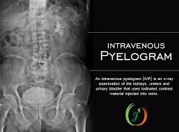 Intravenous Pyelogram Radiology Schools Intravenous Nclex Rn Review