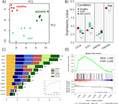 Pathophysiology of community acquired pneumonia. Transcriptional Analysis Identifies Potential Biomarkers And Molecular Regulators In Pneumonia And Copd Exacerbation Scientific Reports