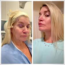 Andrew Jacono, MD-The New York Center for Facial Plastic and Laser Surgery 