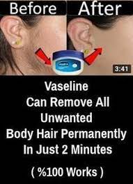 In 2 Minutes Remove All Body Unwanted Hair Permanently At Home With Vaseline Slideten Unwanted Hair Permanently Unwanted Hair Unwanted Hair Removal