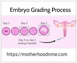 Embryo Grading Embryo Transfer Human Embryo Good Grades