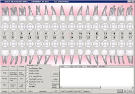 19 Surprising How To Chart Dental Restorations