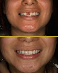 My Dental & Implants