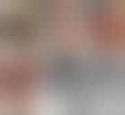 Image result for toe amputation