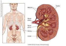 The key, as is the … Kidney Cancer Medical Illustrations Cancer Net