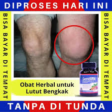 Cara mengobati keseleo yang dengan memijat atau mengurutnya ini tidak boleh anda lakukan selain menggunakan jahe anda juga dapat mengurangi pembengkakan akibat keseleo menggunakan air arang. 100 Alternatif Obat Lutut Bengkak Obat Alami Sakit Lutut Sembap Herbal Kembung Di