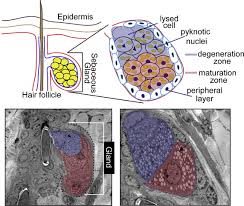 Image result for Sebaceous Gland