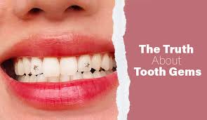Average cost for tooth extraction in united states. The Truth About Tooth Gems Are They Safe Or Dangerous