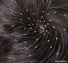 Your clothing seams are the most common places for body lice to lay their eggs (nits). Pin On Black People Get Lice