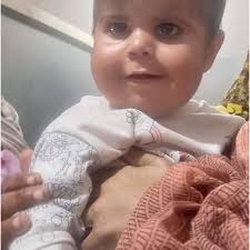 PDF) BETAMETHASONE cream to treat diapers rash causing Cushing syndrome