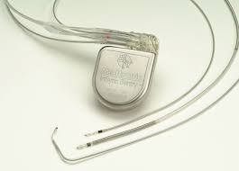 Il defibrillatore cardiaco impiantabile, o defibrillatore cardioverter impiantabile o icd, è un defibrillatore di dimensioni ridotte, portatile e capace di monitorare il ritmo cardiaco di un individuo e impartire una scarica elettrica al cuore al momento del bisogno. Cuore Infarto Fluidi Corporei Defibrillatore Pacemaker Bioblog