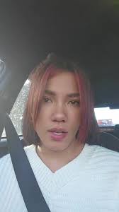 Selsun: Say Goodbye to Dandruff! Best Tips & Shampoo