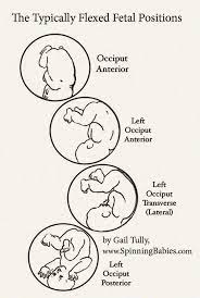 Flexion Matters Spinning Babies