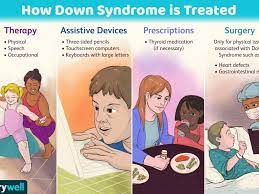 How Down Syndrome Is Treated