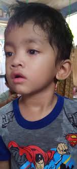 Tolong! Nyawa Anak Saya Bisa Terancam Apabila Tak Operasi Jantung Segera