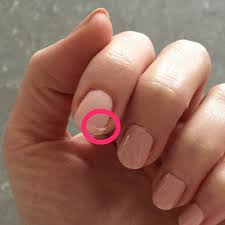 Les plus bas en premier prix: Ongles Cassants Dedoubles Ou Stries Causes Et Traitements