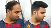 Hair Wig For Men Price