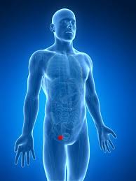 Image result for Inguinal hernia man