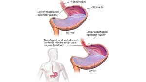 Lower right back pain can be due to a variety of systemic, orthopedic, or neurological causes. Burning Sensation Causes And Treatment