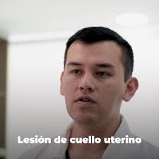 Cuello Uterino