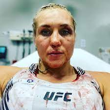 Yana kunitskaya is not clear, but it is estimated between $1 million to $5 million. Ytxwvtwlriigdm