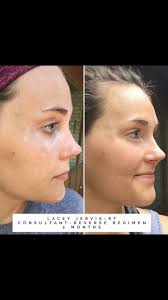 What Wonderful American'' Clear lines, healthy skin, no extremes...  CINCIRIPINI'S PRESTON ⚔ ⚔⚔ ❁❁ Junior Champion Ukraine ❁❁ Champion Ukraine.