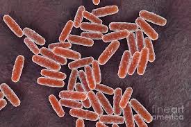 Image result for yersinia fotos