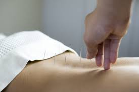 Acupuncturists, and other practitioners of acupuncture and oriental medicine (aom), use traditional chinese medical practices to treat pain. How Long Does It Take To Become An Acupuncturist Aiam