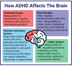 Adhd is one of the most common neurodevelopmental disorders of childhood. What Is Adhd An Overview Of The Causes And Signs Of Adhd Verdugo Psychological Associates