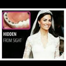 Celebrities Who Got Braces | Before & After