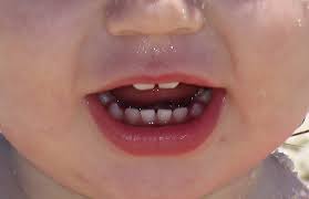 The teeth are the hardest substances in the human body. Why Baby Teeth Are Important Even If They Fall Out Inspirelle