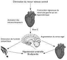 Le malaise vagal appelé aussi malaise vasovagal est un malaise pouvant être attribué à une activité élevée du système nerveux sympathique ou à l'inverse à une quand à la personne qui a un malaise vagal, la source fait suite au ralentissement de la fréquence cardiaque. Syncope Vasovagale Test Diagnostique Et Prise En Charge