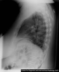 ◄ go back to general radiograhy page◄ go back to <a href=/ target=_self>wikiradiography</a> home page. Peptic Ulcer Disease Knowledge Amboss