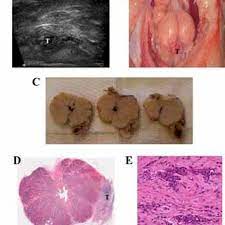 The flint animal cancer center recommends watching for the following signs of illness: Appearance Of Subcapsular Ace 1 Prostate Cancer In Dogs A Transrectal Download Scientific Diagram