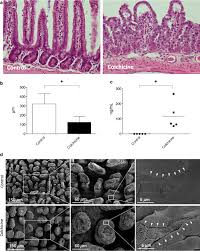 Image result for Colchicine Toxicity