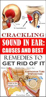 The leading cause of ear crackling we need to know is ear wax. How To Get Rid Of Crackling Sound In Ear Arxiusarquitectura