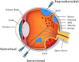 Check spelling or type a new query. Frontiers Crispr Technology For Ocular Angiogenesis Genome Editing