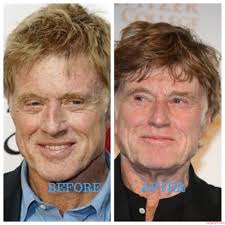 Jamie Lee Curtis Plastic Surgery Photos [Before & After]