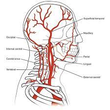 The arteries in neck that supply blood to the brain are called carotid arteries. External Carotid Artery Radiology Reference Article Radiopaedia Org