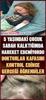 5 Yasindaki Cocuk Sabah Kalktiginda Hareket Edemiyordu Doktorlar Kafasini Kontrol Edince Gercegi Ogrendiler Health
