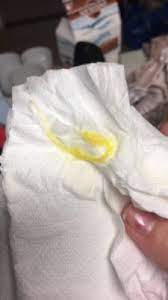 4w5d Yellow Discharge Getting Pregnant Babycenter Australia