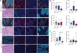 They can remind us of a place, a time of year, or our favorite traditions, and can also shape the way we feel. Plos One Developing An Enhanced 7 Color Multiplex Ihc Protocol To Dissect Immune Infiltration In Human Cancers