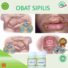 Penularan sifilis bisa juga terjadi dari wanita yang hamil kepada bayi yang dikandungnya. Obat Sipilis Sifilis Wanita Raja Singa Kencing Nanah Alat Vital Pria Gonore Kelamin Sakit Original Shopee Indonesia