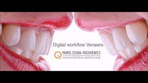 Open kitchen with wooden cabinets and island stove. E Max Veneers Crowns And Direct Composite Carestream Cs3600 Intraoral Scan Youtube