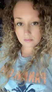 Is rheumatoid arthritis linked to other autoimmune issues?